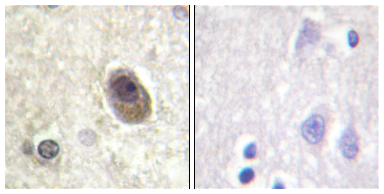 Polyclonal Rabbit anti-Human BAD Antibody (phospho-Ser134, IHC, IF, WB)