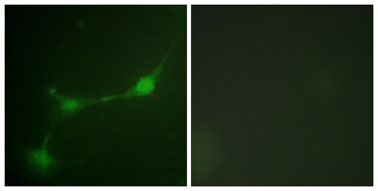 Polyclonal Rabbit anti-Human ATXN1 / SCA1 Antibody (phospho-Ser776, IF, WB)
