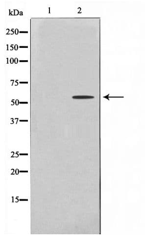 CYP2U1 Antibody