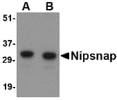 Polyclonal Rabbit anti-Human NIPSNAP1 Antibody (IHC, IF, WB)