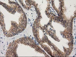 CTNNB1 / Beta Catenin Antibody (clone OTI1E10, Carrier-free)