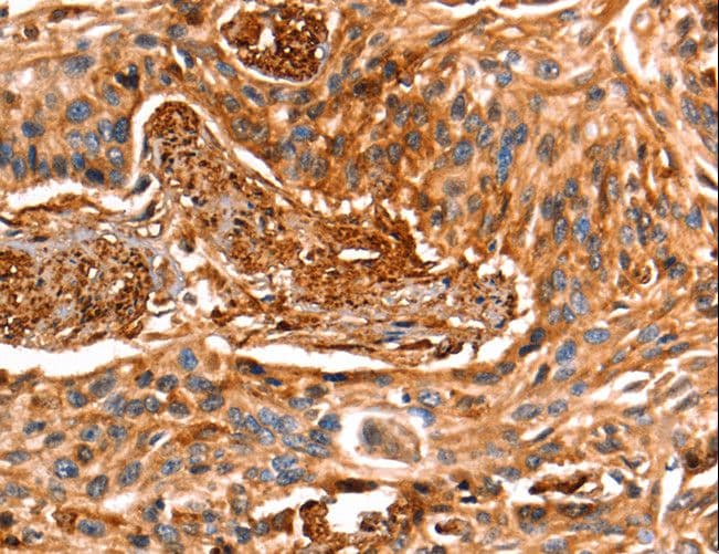 LGALS1 / Galectin 1 Antibody