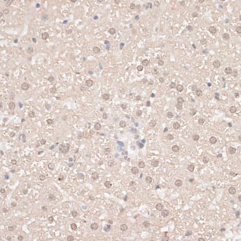 Polyclonal Rabbit anti-Human GPKOW Antibody (IHC, WB)