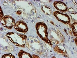 PSMB9 Antibody (clone OTI3H1)