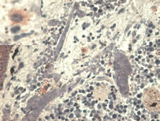 Monoclonal Mouse anti-Human HLA-G Antibody (clone MEM-G/1, IHC, WB)