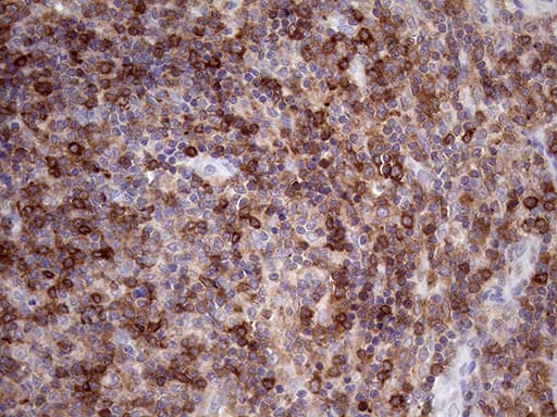 DGKZ Antibody (aa734-808, clone OTI1A6)