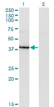 Monoclonal Mouse anti-Human HDAC8 Antibody (clone 2F4, WB)