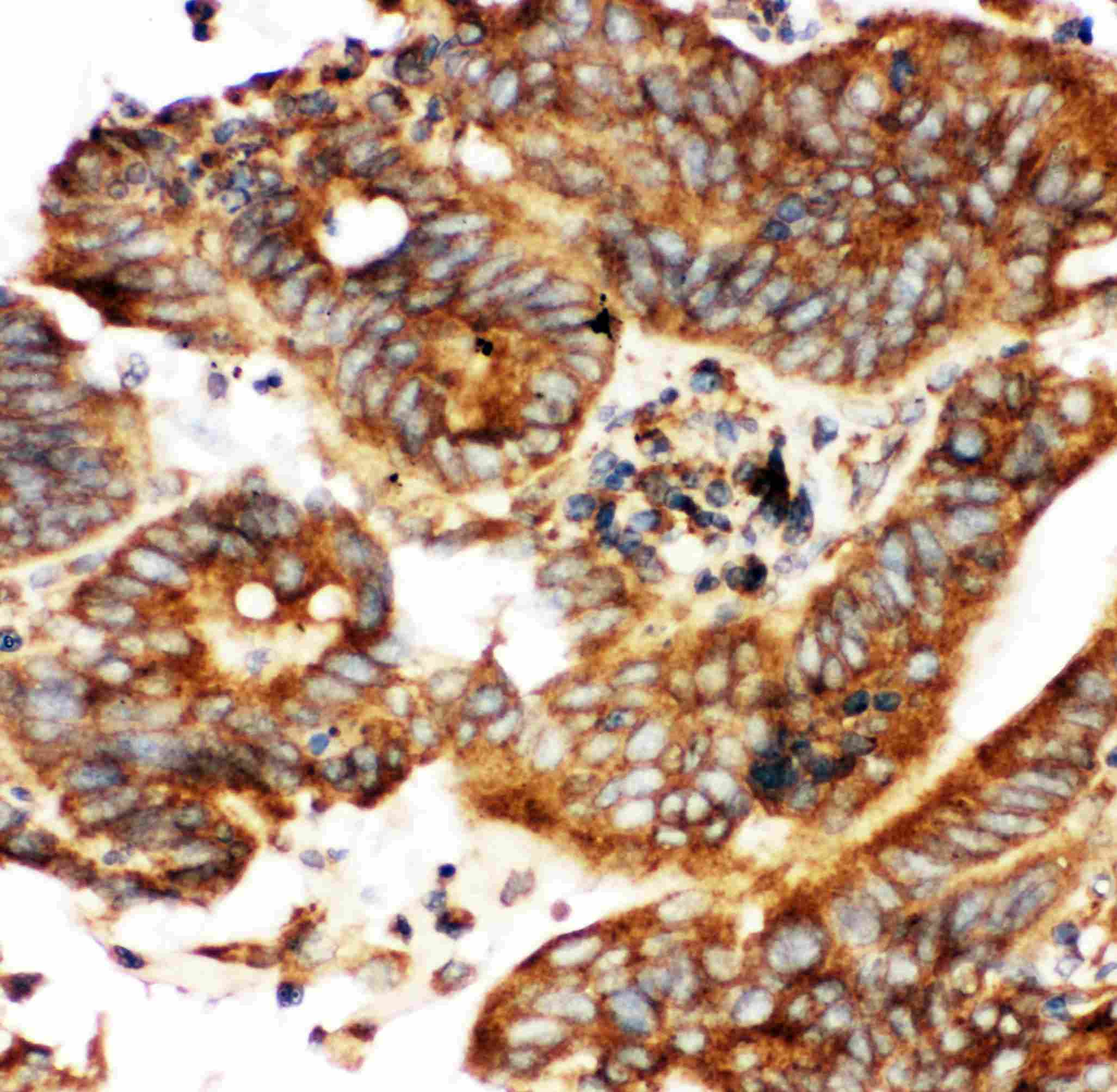 CALB1 / Calbindin Antibody (aa2-175)