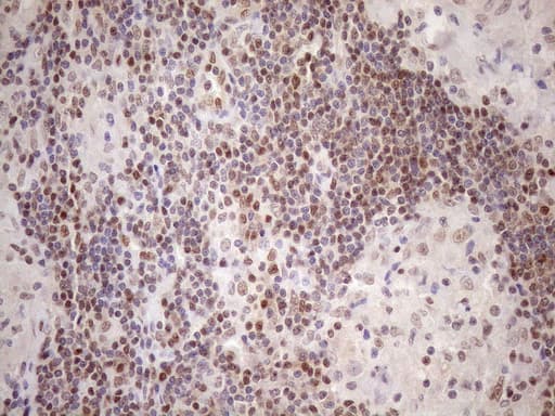 MGMT Antibody (clone OTI5A7)