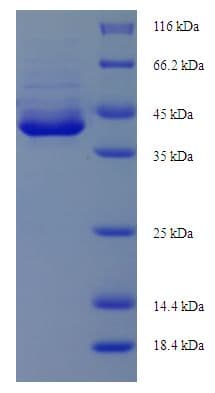 Human AEN Protein (Recombinant His-SUMO)