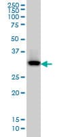 Monoclonal Mouse anti-Human QPRT Antibody (clone 5D11, IHC, WB)