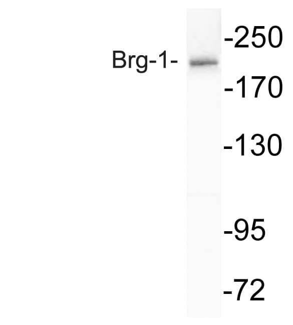 SMARCA4 / BRG1 Antibody (Arg1614)