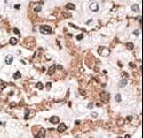 KCNIP3 / Dream / Calsenilin Antibody (aa1-30)