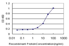 DLX1 Antibody (clone 2H3)