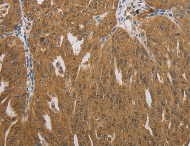 NIT2 Antibody
