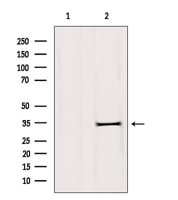 Polyclonal Rabbit anti-Human DHRS1 Antibody (WB)