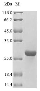 Human HLA-DMB Protein (Recombinant 6His, N-terminus)