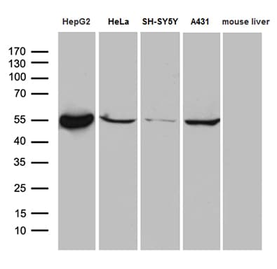 Monoclonal Mouse anti-Human ALDH7A1 Antibody (clone OTI10A12, IHC, WB)