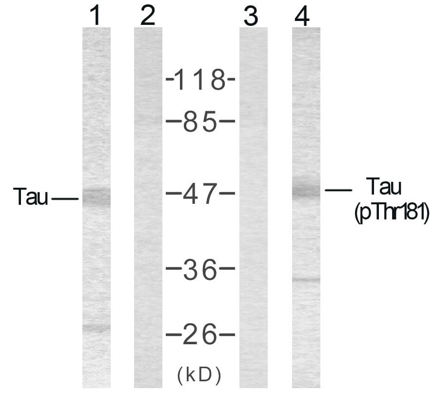 MAPT / Tau Antibody (phospho-Thr181)