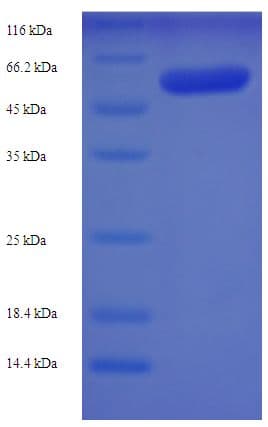 Human SKAP1 / SCAP1 Protein (Recombinant His-SUMO)