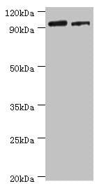 IHC-plus™ HIF1A / HIF1 Alpha Antibody (aa 579-826)