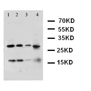 Polyclonal Rabbit anti-Human IFN Gamma / Interferon Gamma Antibody (aa151-166, WB)