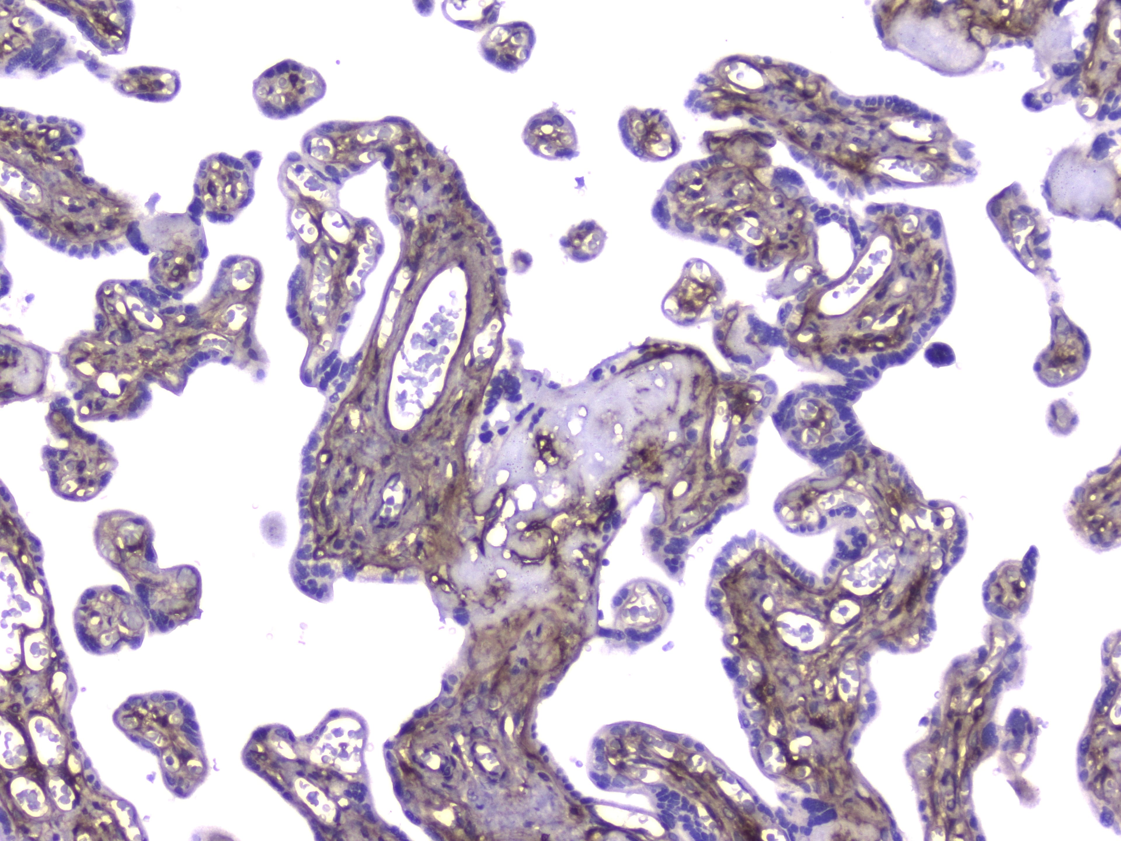 COL4A1 / Collagen IV Alpha1 Antibody