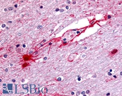 PathPlus™ Polyclonal Rabbit anti-Human GPR182 / ADMR Antibody (N-Terminus, IHC, WB)