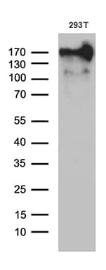 Monoclonal Mouse anti-Human MRC2 / Endo180 Antibody (clone OTI9G4, IHC, WB)