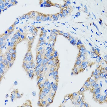 US01 / p115 Antibody