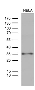 ZMAT4 Antibody (clone OTI9E11)