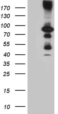Monoclonal Mouse anti-Human HDAC9 Antibody (clone OTI7G9, aa181-460, WB)