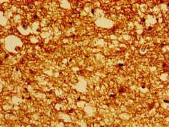 Polyclonal Rabbit anti-Human PRMT1 Antibody (IF)