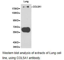COL5A1 / Collagen V Alpha 1 Antibody