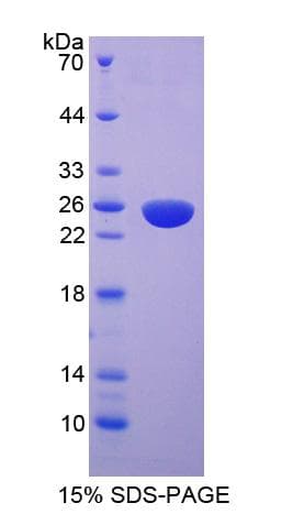 Rat MYLK2 Protein (Recombinant His-T7)