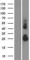 TMEM52 Protein (Over-Expression Lysate Myc-DDK (Flag))