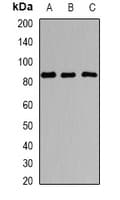 IHC-plus™ Polyclonal Rabbit anti-Human SOX5 Antibody (IHC, IF, WB)