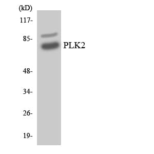 SNK / PLK2 Antibody (aa279-328)