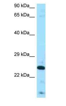 FGF8 Antibody (aa104-153)