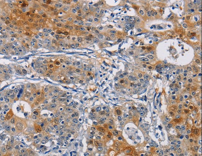 GSTA2 Antibody