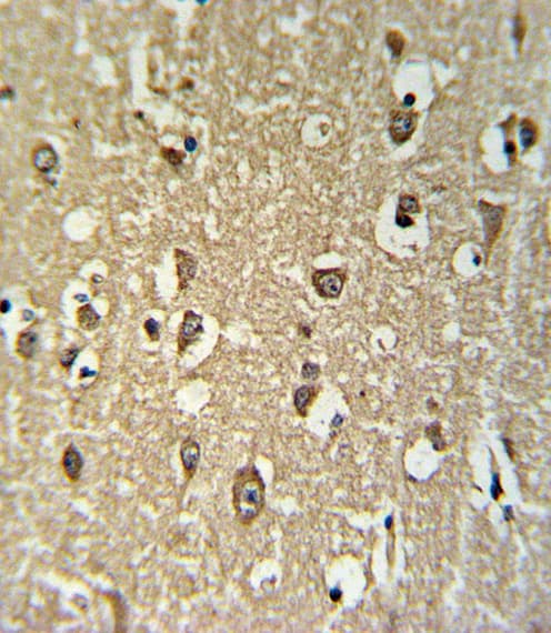 CHRNA3 Antibody (aa25-52)