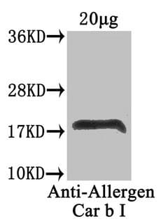 Car b 1 Isoforms 1A+1B Antibody (aa2-160)