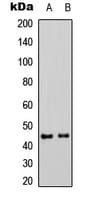 MAP2K1 / MKK1 / MEK1 Antibody (phospho-Ser298)