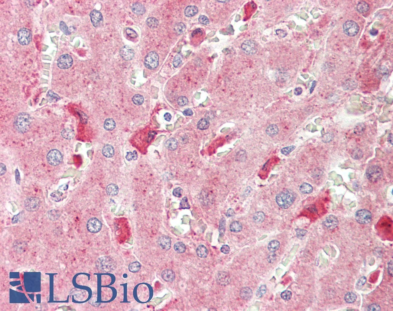 CCL2 / MCP1 Antibody (HRP)