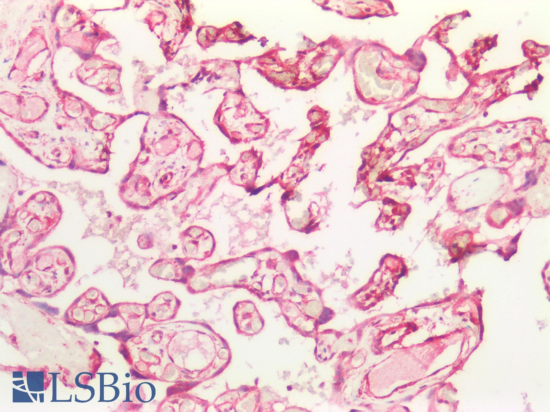 IHC-plus™ Polyclonal Rabbit anti-Human TGFBR1 / ALK5 Antibody (IHC, IF, WB)
