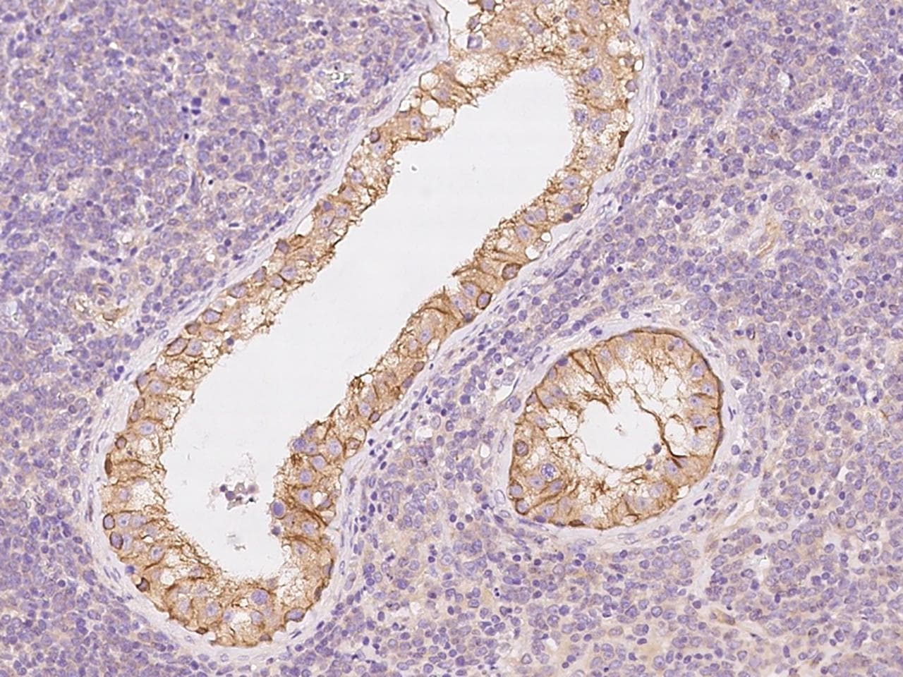 Polyclonal Rabbit anti-Human PPP2R1B Antibody (IHC, IF)