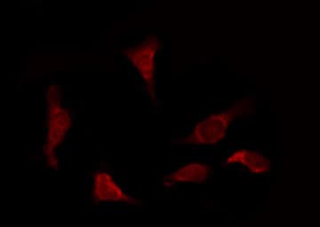 Polyclonal Rabbit anti-Human CYCS / Cytochrome c Antibody (IHC, IF, WB)