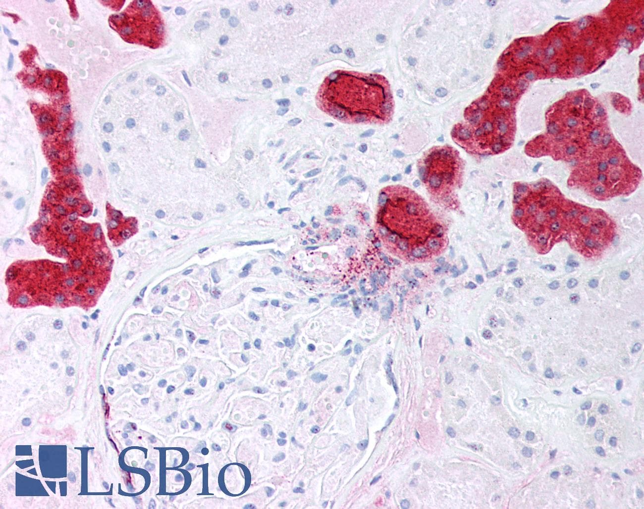 PathPlus™ EMA / MUC1 Antibody (clone ABT-EMA)