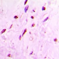 UMPS / OPRT Antibody