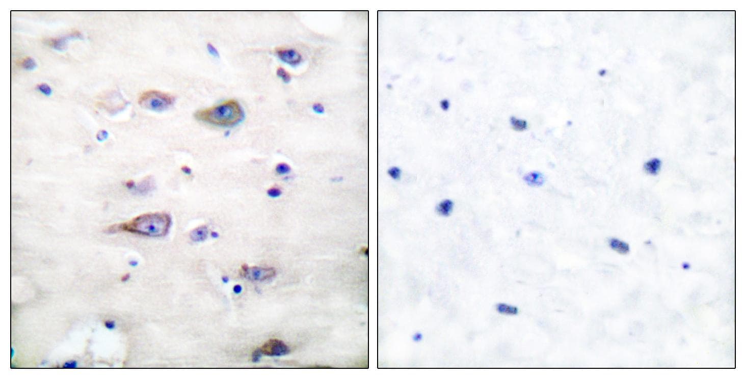 Polyclonal Rabbit anti-Human GRIA2 / GLUR2 Antibody (phospho-Ser880, IHC, WB)